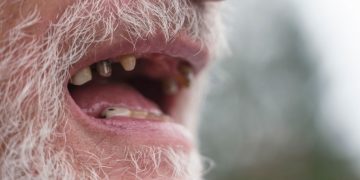 Rotten Tooth - Drømmenes Betydning Og Symbolik 19